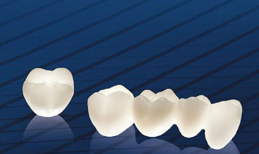 Các cách phân biệt răng sứ Cercon và Cercon ht bạn nên biết